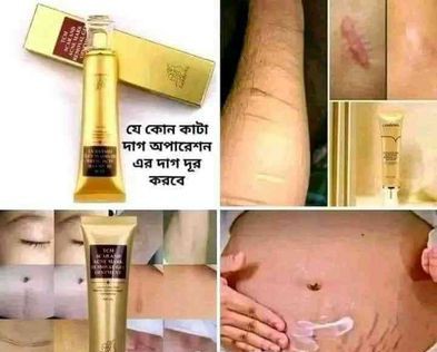 Bd.TCM scar removal cream Original for sale in Mirpur, Dhaka